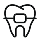 Invisible braces